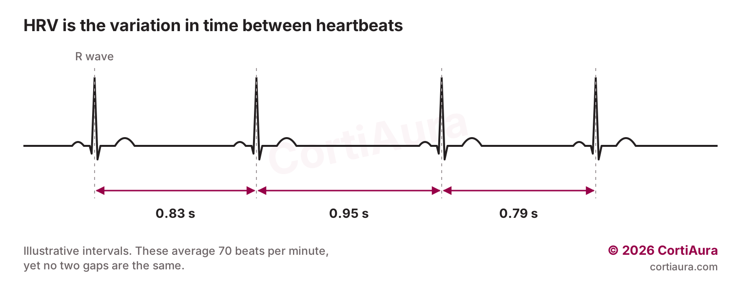 ECG trace showing three different time gaps between heartbeats, 0.83, 0.95 and 0.79 seconds